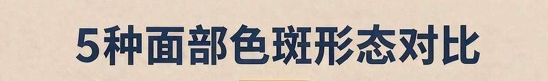 长沙结节性多动脉炎怎么处理？3个就医与日常要点就医示意