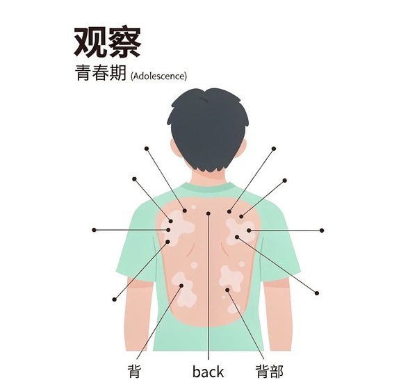 C27 白癜风日常护理示意图 2